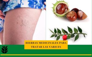 Hiervas medicinales para las varices